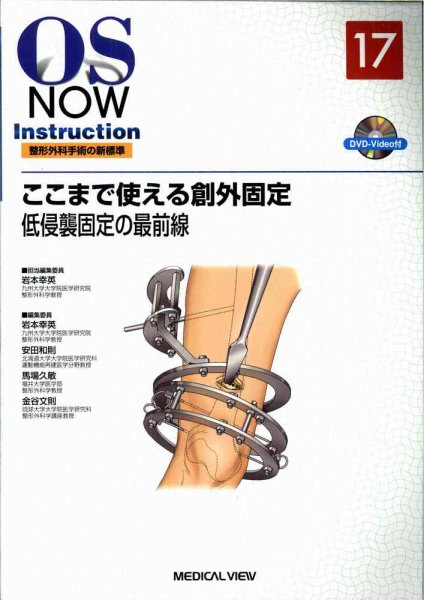 AO法骨折治療 Internal Fixators [英語版DVD-ROM付] | 書籍詳細 | 書籍