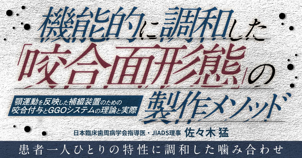 なるべく安全にインプラントを撤去する方法。｜歯科オンラインセミナー