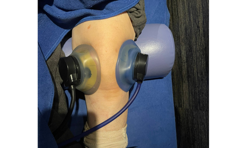 膝の痛み・動かし悩みの方へ — ES-530（伊藤超短波）で“深く・やさしく