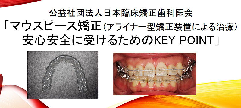日本臨床矯正歯科医会がマウスピース矯正（アライナー矯正）治療で知っ
