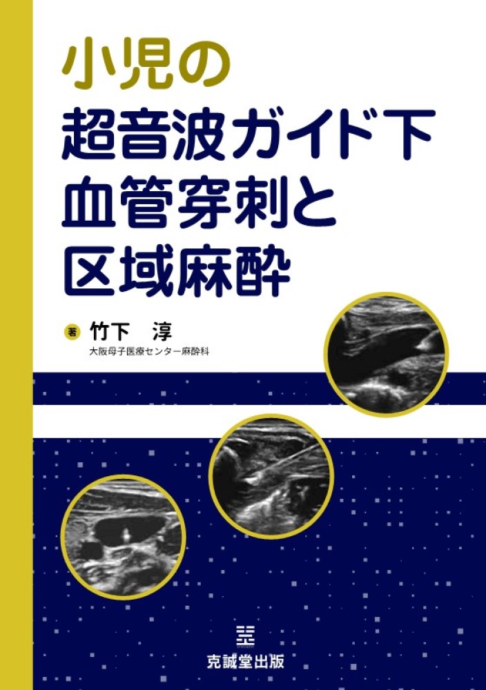Hadzic's 超音波ガイド下末梢神経ブロックと解剖 裁断済み 裁断済