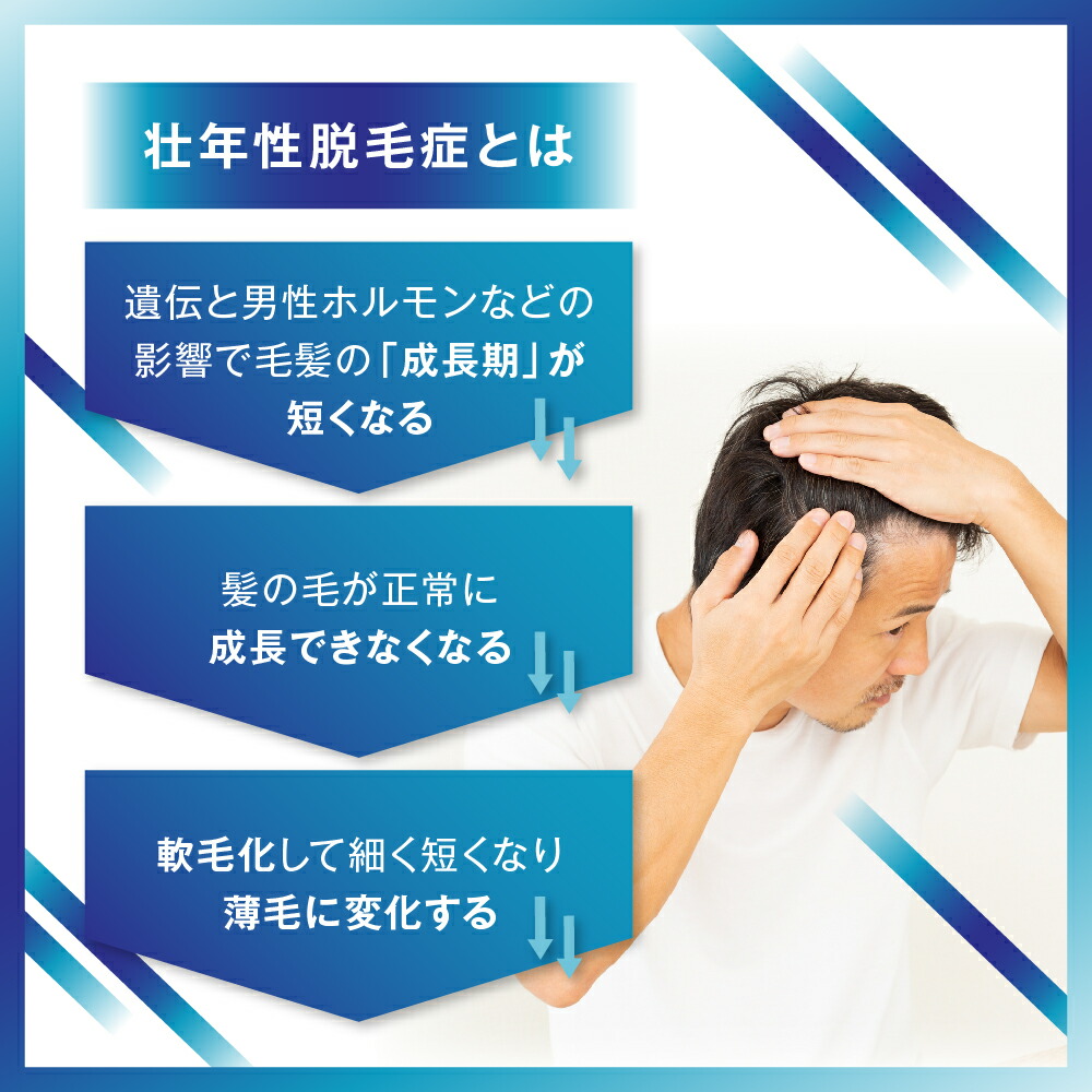 Oops 育毛・スカルプケア フィナステリ&ミノキ Oops 育毛・スカルプ