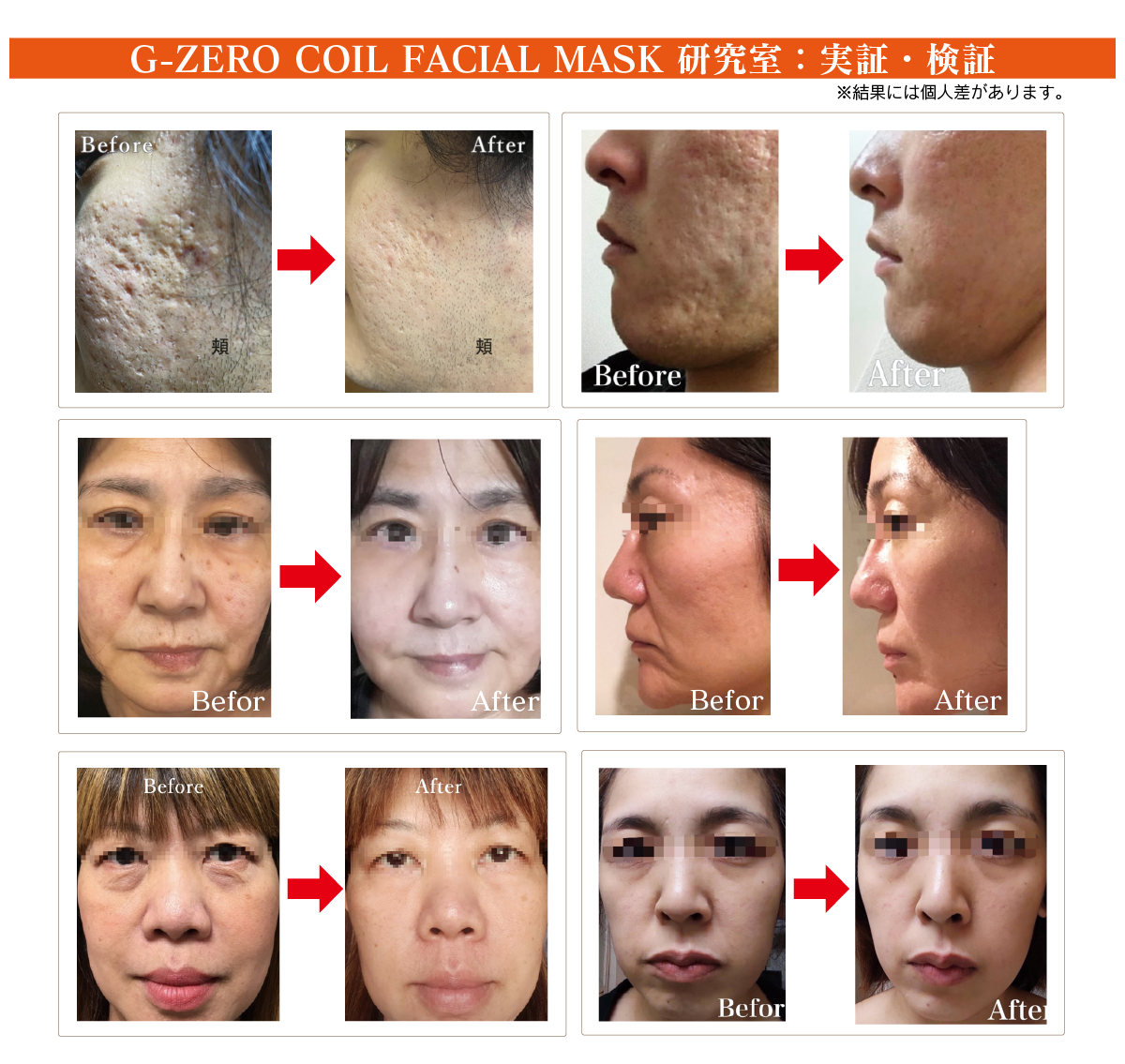G-ZERO COIL FACIAL MASK｜マリスローレン