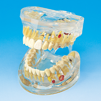NISSIN DENTAL MODEL 可動式上下顎模型 NISSIN DENTAL MODEL 可動式上