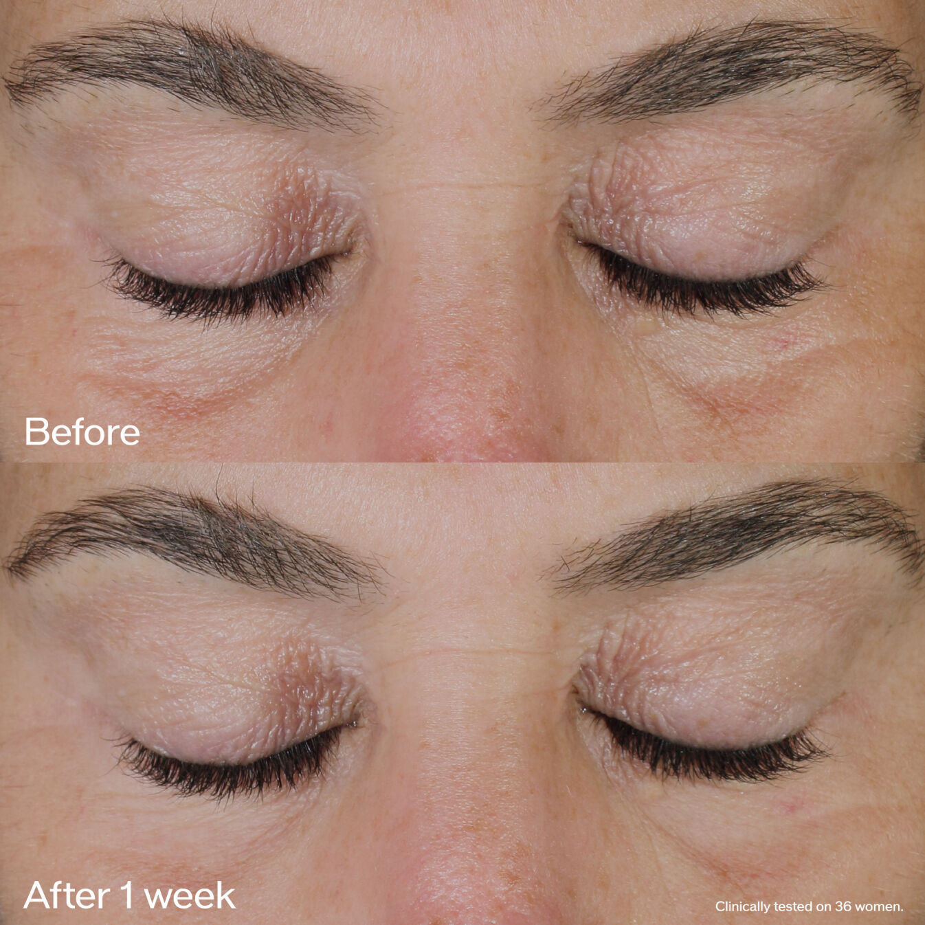 Firming Eye Lift Cream | SHISEIDO