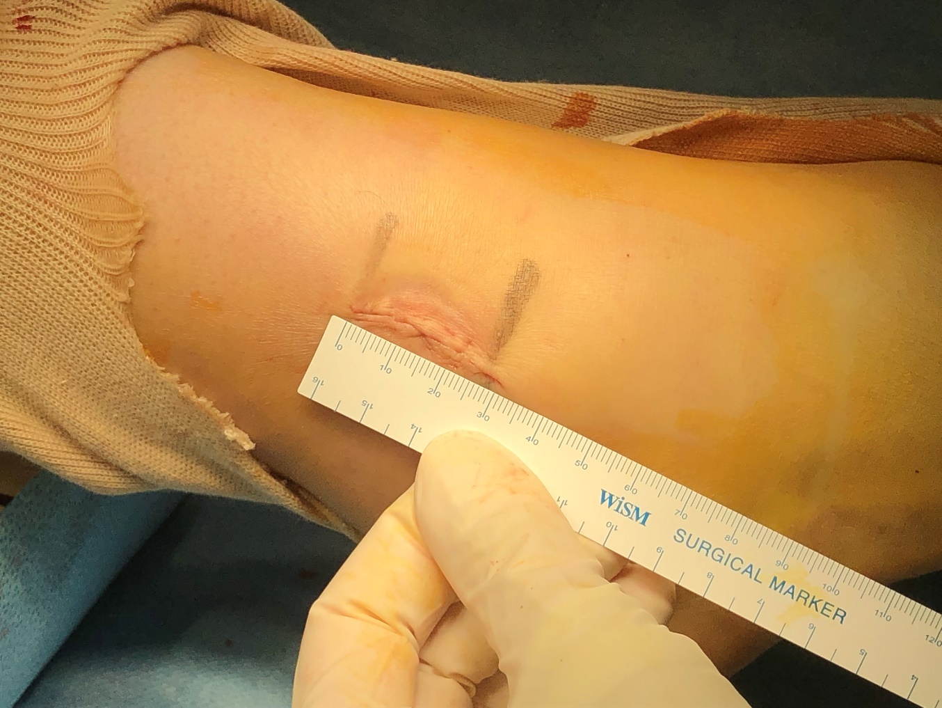ph_case_foot_10_2.jpg