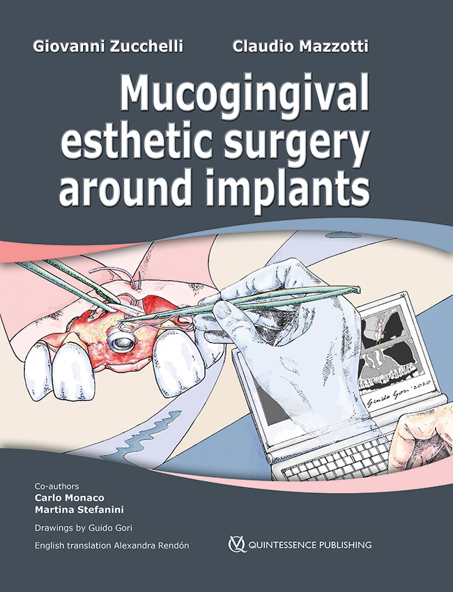 Vertical 2: The Next Level of Hard and Soft Tissue Augmentation