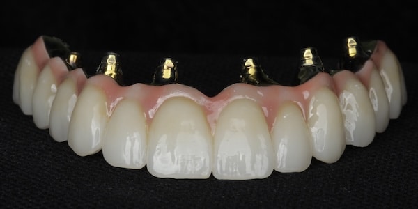 All-on-X and All-on-4 - Middle Tennessee Prosthodontics