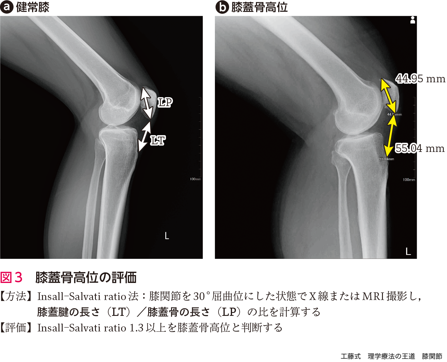 工藤式 理学療法の王道 膝関節〜解剖学×運動学×臨床知による評価と介