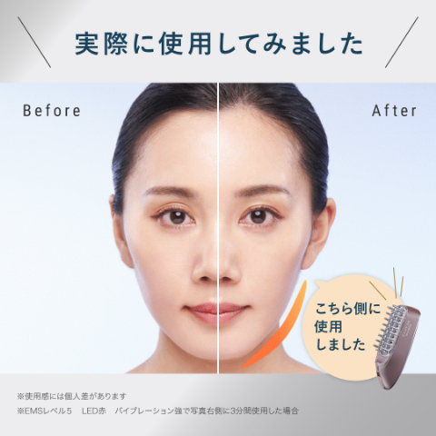 アンファースカルプD公式通販 | 予防医学のアンファーストア