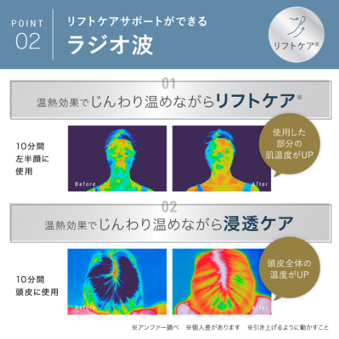 アンファースカルプD公式通販 | 予防医学のアンファーストア