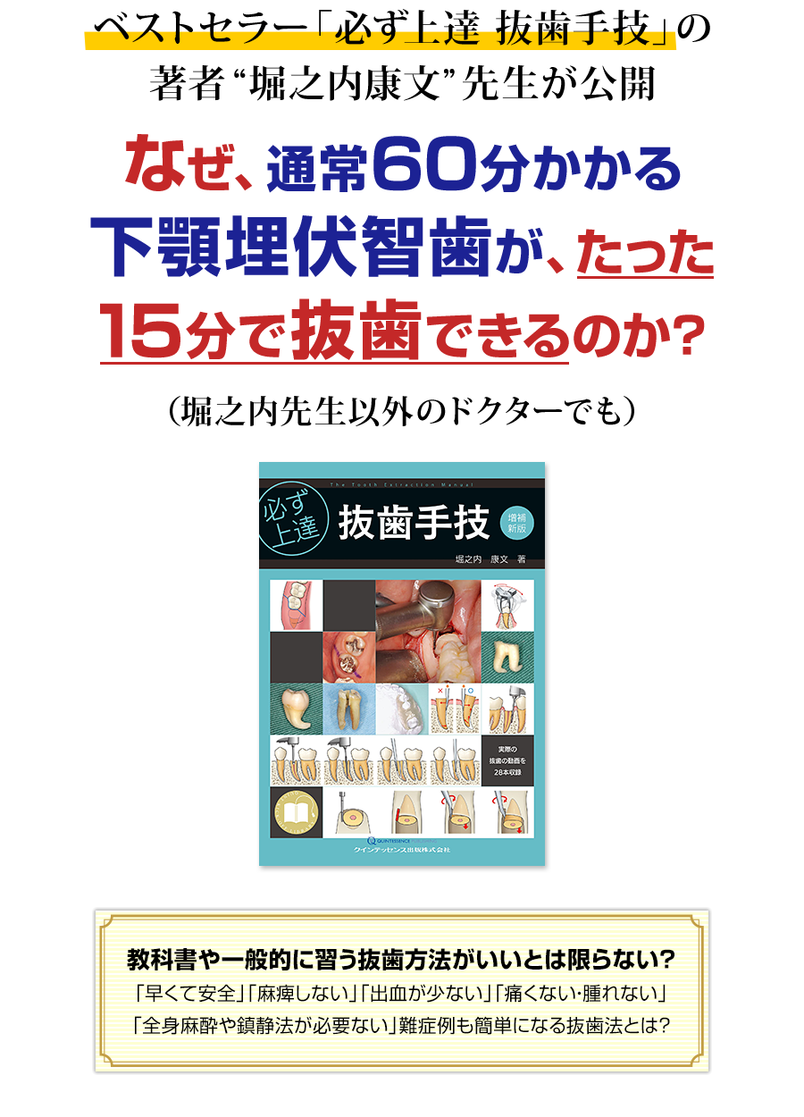 株式会社 医療情報研究所 | 難症例も単純化！学校では教えてくれない抜歯術