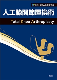 人工膝関節置換術: 書籍／南江堂