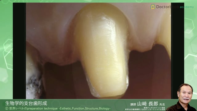 Esthetic Classifications 山崎長郎著 世界に通用する補綴治療の実践