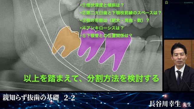 知っておくべき智歯の事前知識 解剖・麻酔・分類│完全版！埋伏抜歯の