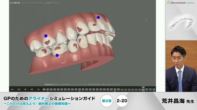 GPのためのアライナーシミュレーションガイド 〜これだけは覚えよう