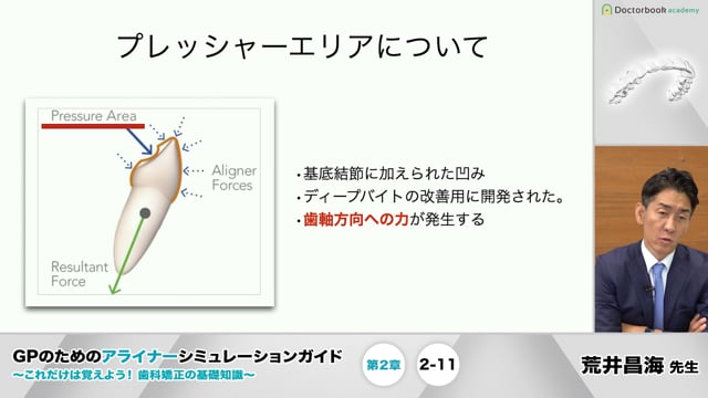 GPのためのアライナーシミュレーションガイド 〜これだけは覚えよう