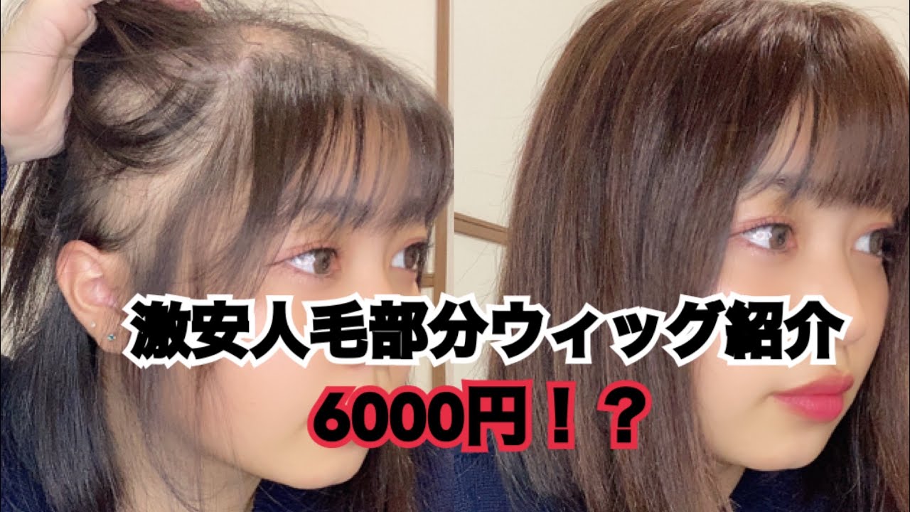 Alopecia] I found another cheap 100% human hair partial wig