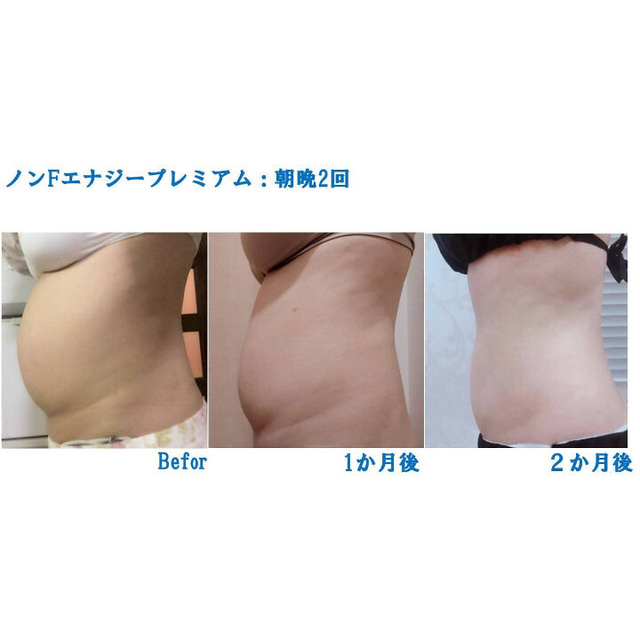 ノンFエナジープレミアム(背中・太ももガチガチ) | Esthesalon HaleOla
