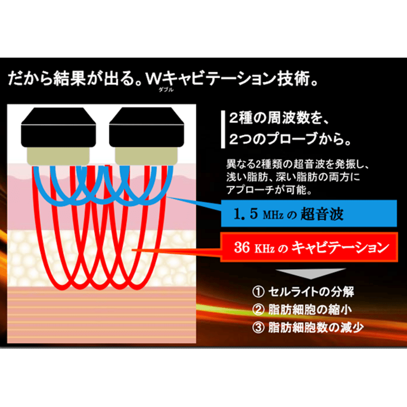 キャビゼロ -cavi ZERO- | プロ用美容エステ機器 プロ用化粧品の販売 C