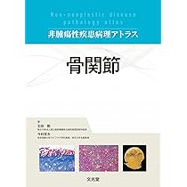 7185bCeA0OL._AC_UL210_SR210,