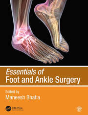 Essentials of Foot and Ankle Surgery - 1st Edition - Maneesh Bhatia -
