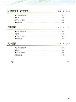 骨折 プレート治療マイスター−改訂第2版 | 澤口 毅 |本 | 通販 | Amazon