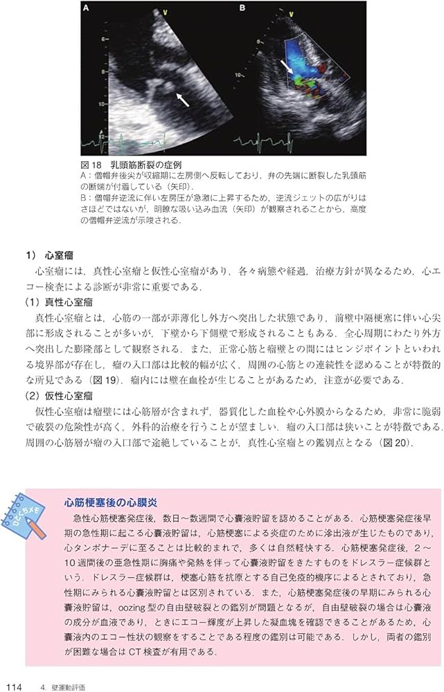 心臓超音波テキスト 第3版 | 日本超音波検査学会, 種村 正, 髙橋 秀一