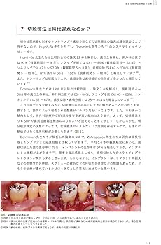 エビデンス×臨床判断から導く実践的歯周治療 | 星 嵩 |本 | 通販 | Amazon