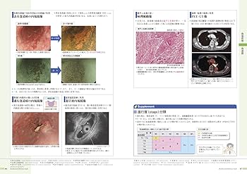 病気がみえる1-13 病気がみえる vol.1 消化器 第6版 | 医療情報科学
