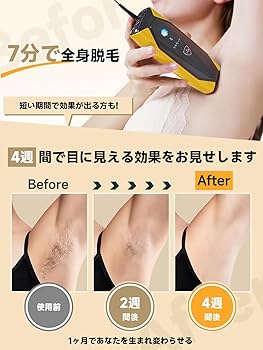 Jovs DORA 脱毛器 本体・電源コード・サングラス付き JOVS（ジョブズ
