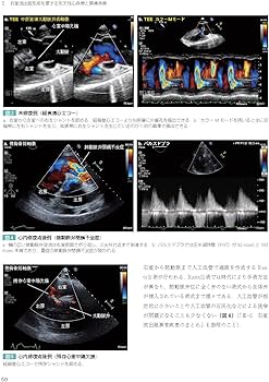 早わかり 成人先天性心疾患の心エコー評価攻略ガイド | 松尾 浩三