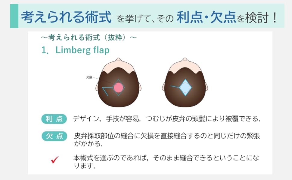 局所皮弁塾 あなたならこの顔の欠損をどう治す？ | 四ッ柳高敏 |本