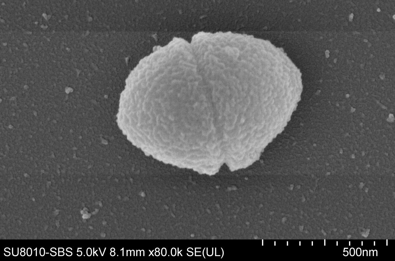 bacteria-commonly-foun-1.jpg
