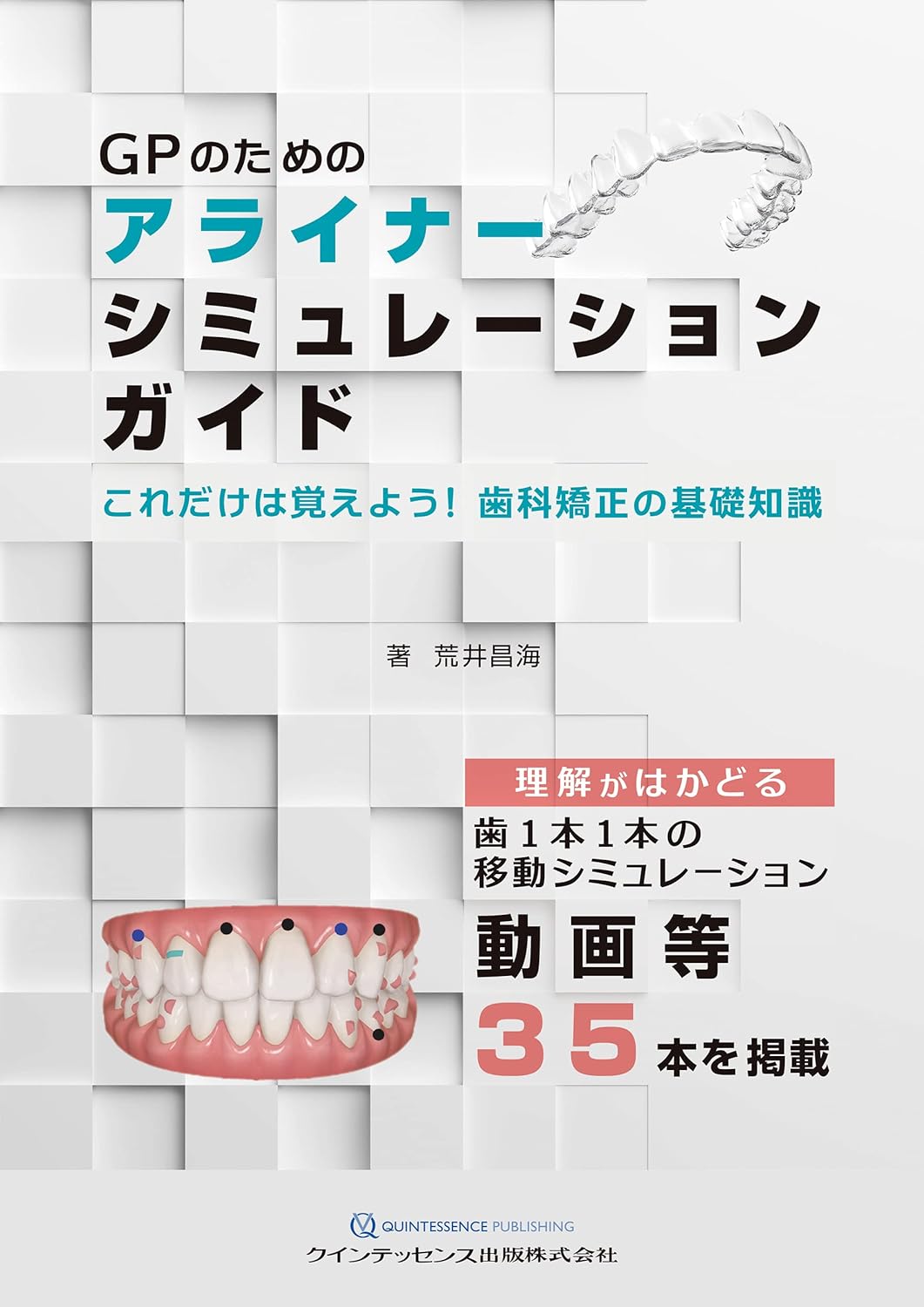 第4章 移動量と移動限界│GPのためのアライナーシミュレーションガイド