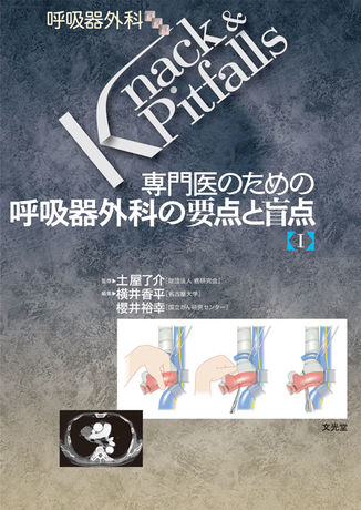 呼吸器外科の要点と盲点Ⅰ（電子版のみ） | 株式会社文光堂
