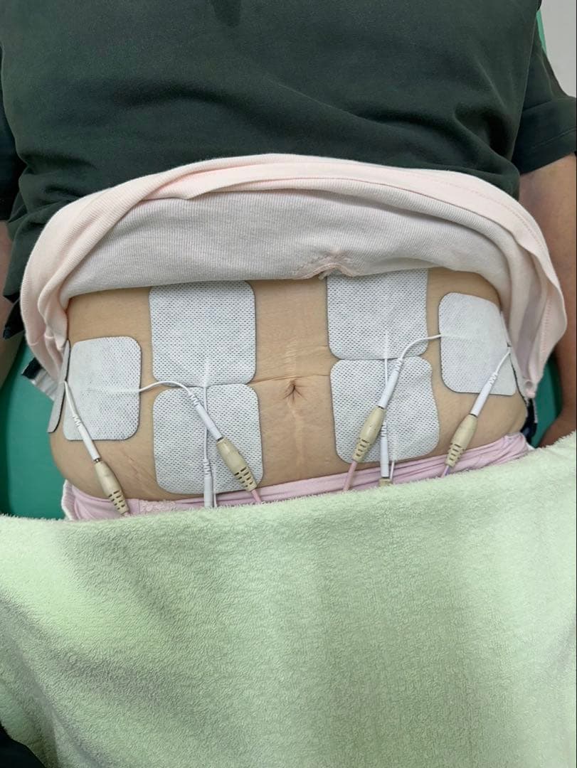 EMS粘着パッド40枚　整骨院楽トレ　バイトレJOYトレEMSパット 電極パッド EMS・低周波用交換粘着スナップパッド (5x5cm角形4個) : E-PAD EMS低